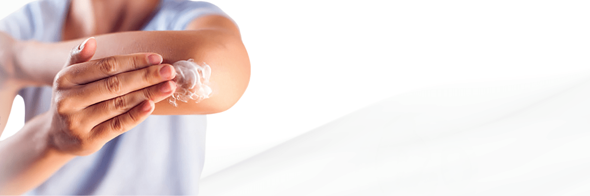 Eczema Treatment In Hyderabad