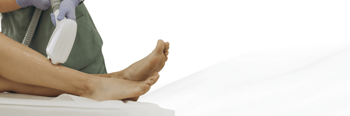 laser hair removal treatment