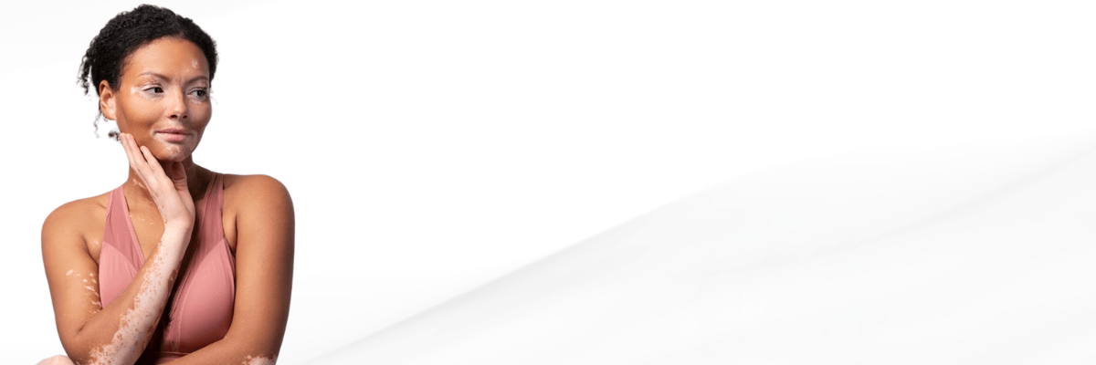 Eczema Treatment In Hyderabad