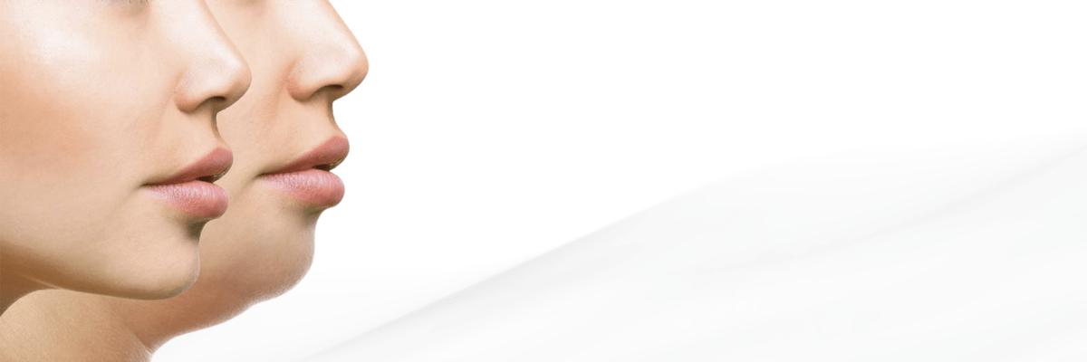 Double Chin Treatment