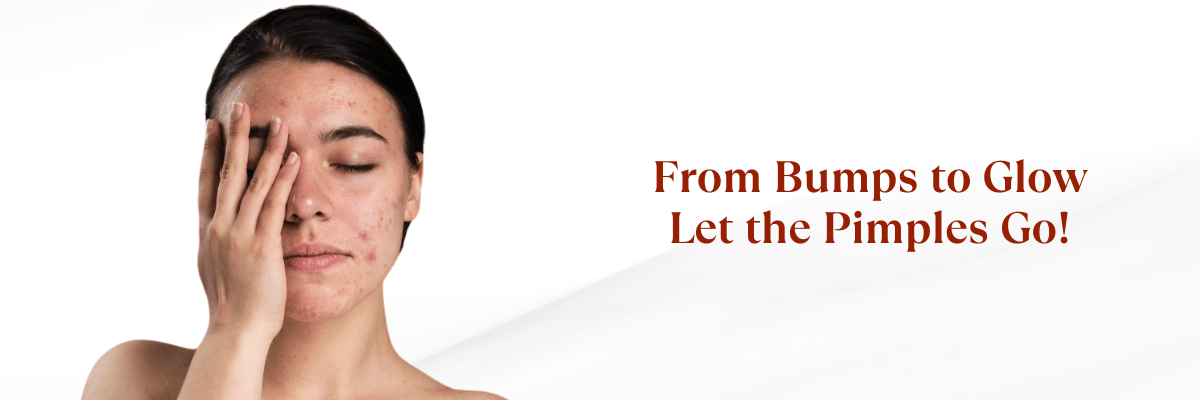 Pimple removal treatment